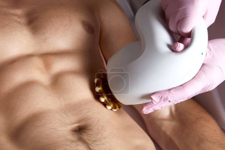 Man receiving fat reductive skin lifting body treatment on modern equipment at cosmetology clinic, male body care concept