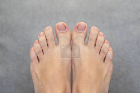 Photo for Closeup of feet and toes. Healthy bare feet and footcare concept - Royalty Free Image