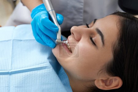 Téléchargez les photos : Jeune femme se faire polir les dents dans une clinique dentaire moderne - en image libre de droit