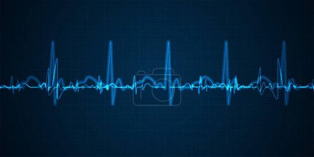 Illustration for Emergency ekg monitoring. Blue glowing neon heart pulse. Heart beat. Electrocardiogram - Royalty Free Image