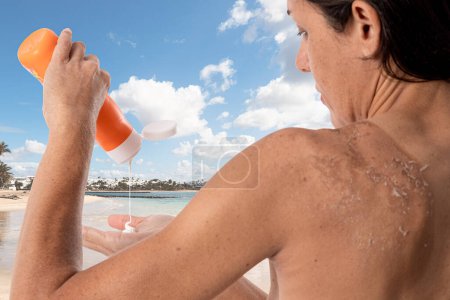 Téléchargez les photos : Dos de femme avec des coups de soleil tenant bouteille de crème solaire. Isolé sur fond blanc avec espace de copie. Format vertical - en image libre de droit