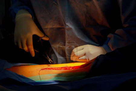 Dans la salle d'opération, les médecins piquent la jambe après qu'elle ait été blessée