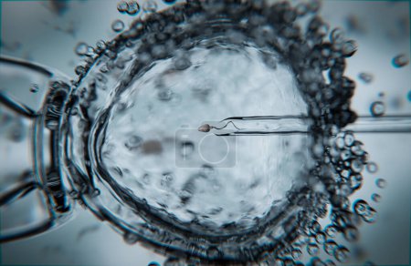 Foto de Fertilización in vitro con inyección intracitoplasmática de esperma - ilustración 3d - Imagen libre de derechos