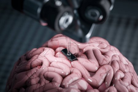 Foto de El concepto de implantar un chip en el cerebro humano con la ayuda de un brazo robótico. Tecnología moderna del futuro. 3d renderizar - Imagen libre de derechos