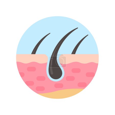 Illustration for Hair follicles on human skin hair disorder hair care - Royalty Free Image