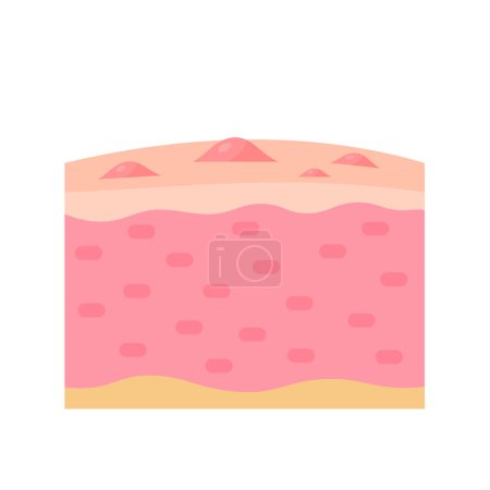 Illustration for Human skin layer Caring for protecting the skin from the sun with a skin serum. - Royalty Free Image