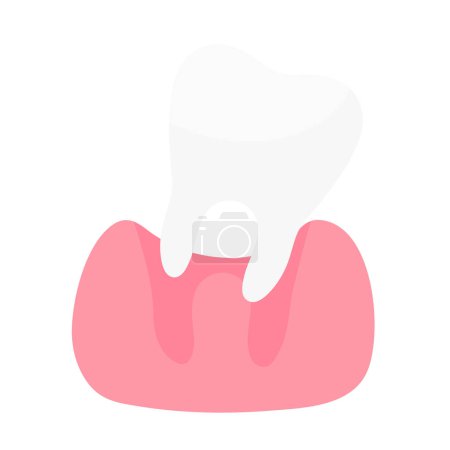 Téléchargez les illustrations : Soins dentaires Résoudre le problème de carie dentaire et de gonflement des gencives dans la bouche. - en licence libre de droit