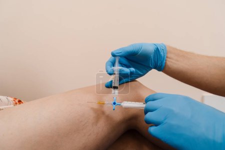 Photo for Vascular surgeon injects chemical solution into woman leg for sclerotherapy procedure. Sclerotherapy injecting into the varicose or spider vein on leg to treat blood vessel malformations - Royalty Free Image