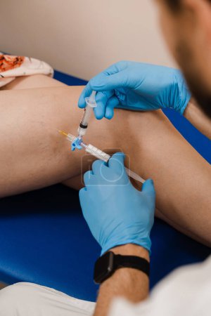 Foto de Sclerotherapy injecting into the varicose or spider vein on leg to treat blood vessel malformations. Vascular surgeon injects chemical solution into woman leg for sclerotherapy procedure - Imagen libre de derechos