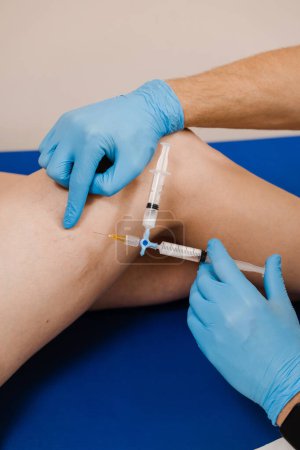Photo for Sclerotherapy injecting into the varicose or spider vein on leg to treat blood vessel malformations. Vascular surgeon injects chemical solution into woman leg for sclerotherapy procedure - Royalty Free Image
