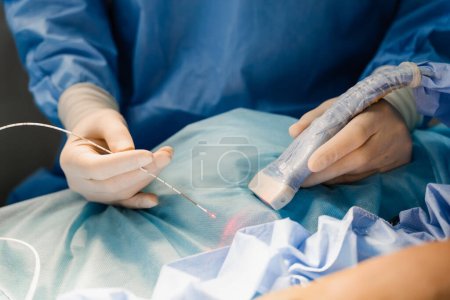 Photo for Endovenous laser coagulation for treatment varicose veins and ultrasound machine. Vascular surgeon with EVLT Red laser optical fiber for treatment thrombophlebitis of legs in operating room - Royalty Free Image