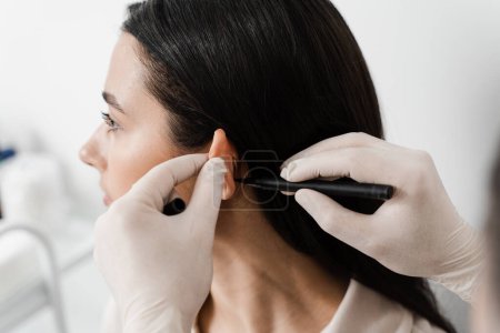 Photo for Otoplasty markup for surgical reshaping of the pinna, or outer ear for correcting an irregularity and improving appearance. Surgeon doctor marking girl ear before otoplasty cosmetic surgery - Royalty Free Image