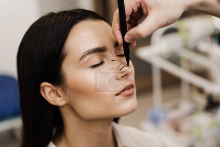 Rhinoplasty markup. Rhinoplasty is reshaping nose surgery for change appearance of the nose and improve breathing. ENT doctor is drawing mark up lines on nose before rhinoplasty surgery