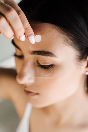 Foto de Mujer joven que usa parches de acné para el tratamiento de la espinilla y la rosácea de cerca. Cosmetología de limpieza del rejuvenecimiento facial. Chica con acné palo redondo parche de acné en su mejilla - Imagen libre de derechos
