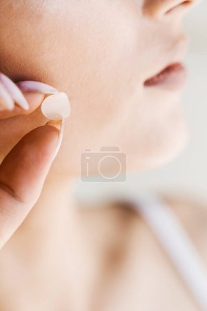 Foto de Chica con parche redondo de acné en la mejilla. Mujer joven que usa parches de acné para el tratamiento de la espinilla y la rosácea de cerca. Cosmetología de limpieza del rejuvenecimiento facial - Imagen libre de derechos