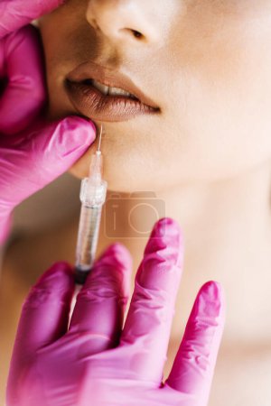 Foto de Close-up inyecciones de aumento de labios en los labios para chica atractiva. Cosmetólogo inyectando ácido hialurónico en los labios para aumentar en clínica médica. Tratamiento facial cosmético rejuvenecedor - Imagen libre de derechos
