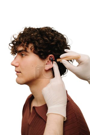 Applying markup on ear pinna to correct the shape of ears. Otoplasty markup making on ear. Surgeon drawing markup lines before Otoplasty surgeon on ears
