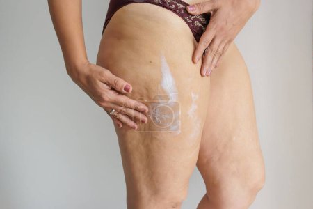 Foto de Mujeres blancas piernas con flacidez y celulitis, en casa - Imagen libre de derechos