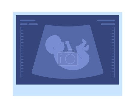 Ilustración de Imagen de ultrasonido fetal objeto vectorial de color semi plano. Progreso del embarazo. Icono editable. Elemento de tamaño completo en blanco. Ilustración simple de dibujos animados estilo spot para el diseño gráfico web y la animación - Imagen libre de derechos