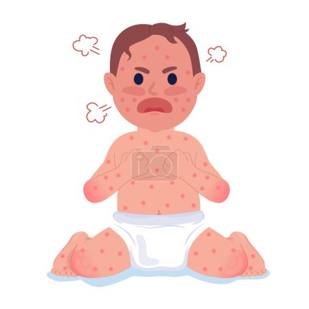 Illustration for Crying baby with measles 2D cartoon character. Little child high fever isolated vector person white background. Chicken pox infant boy in diapers. Chickenpox symptom color flat spot illustration - Royalty Free Image