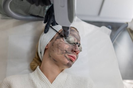 Beautician performs a carbon fiber based skin exfoliation treatment. The cosmetologist administers the carbon face peeling procedure, utilizing specialized equipment for effective results
