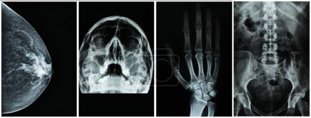 Röntgenbild verschiedener Körperteile wie Brust, Kopf, Hand und Wirbelsäule. Medizinisches Konzept.
