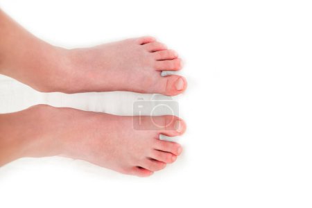 Close-up of legs isolated on white background. Feet on white