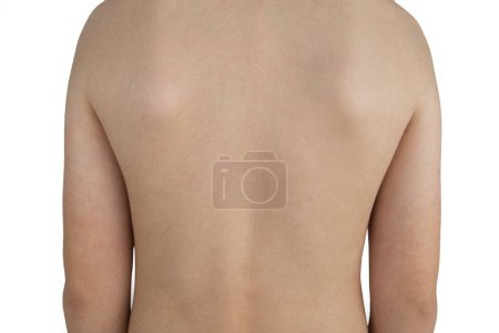 Foto de Vista trasera foto de una espalda desnuda de un niño aislado sobre fondo blanco. Hermosa postura. Espalda plana. - Imagen libre de derechos