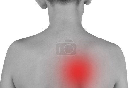 Photo for Close-up black and white photograph of a back with shoulder blade pain. The red color further illustrates the pain. - Royalty Free Image