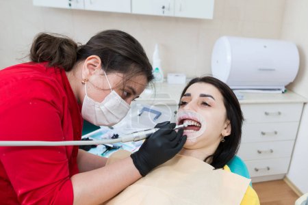 Der Zahnarzt setzt dem Patienten Veneers auf. Der Installationsprozess. Zahnheilkunde, Smile Design, Weiße Zähne. Wiederherstellung der Zähne.