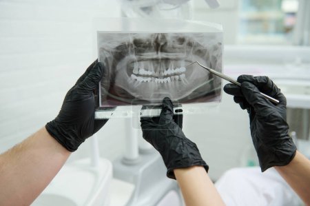 Téléchargez les photos : Gros plan mains en gants chirurgicaux noirs d'une équipe de dentistes orthodontistes, tenir une image radiographique panoramique des dents humaines et discuter du traitement qui doit prescrire ou effectuer dans une clinique dentaire - en image libre de droit