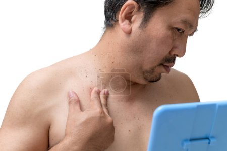 Ein älterer Mann mittleren Alters sorgt sich um Hautmarken oder Akrochordon am Hals, isoliert auf weißem Hintergrund. Gesundheitskonzept