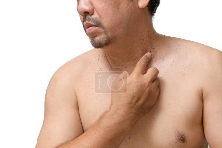 Foto de Hombre mayor de mediana edad apuntan a las etiquetas de la piel o acrocordón en su cuello aislado sobre fondo blanco. Concepto de salud - Imagen libre de derechos
