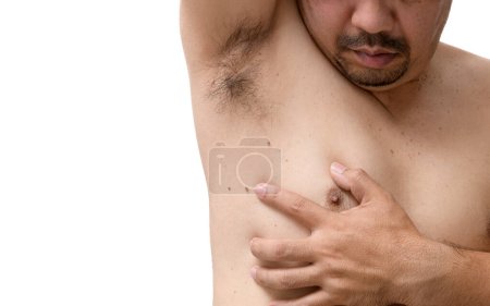 Close up the skin tags on man's skin under the armpits and sides of the body isolated on white background, health care skin concept