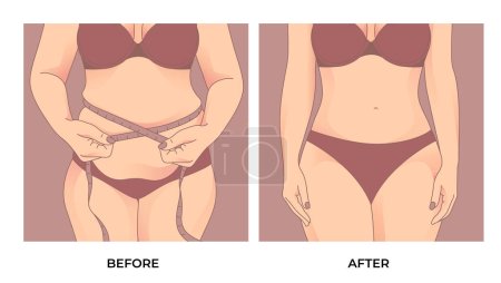 La grasa del vientre. Antes y después de la pérdida de peso, transformación de la forma del cuerpo de la mujer, grasa para encajar.