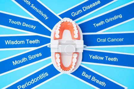 Modelo de prótesis con enfermedad dental sobre fondo azul.