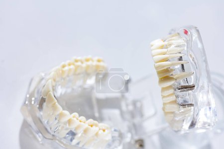 Photo for Model of human jaw. Selective Focus. - Royalty Free Image