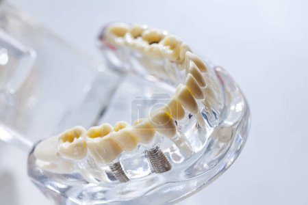 Photo for Teeth education model. Shallow dof. - Royalty Free Image