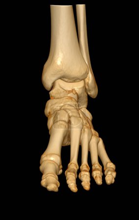 Foto de Representación 3D de los huesos del pie para el diagnóstico de fractura ósea y artritis reumatoide mediante tomografía computarizada. - Imagen libre de derechos