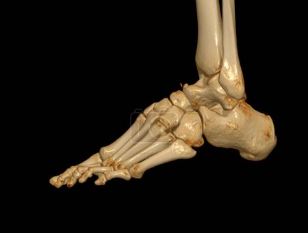 Photo for 3D rendering  of the foot bones for diagnosis bone fracture and rheumatoid arthritis from CT scannner. - Royalty Free Image
