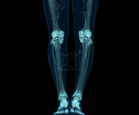 Photo for 3D render of lower extremity or legs isolated on black background. - Royalty Free Image