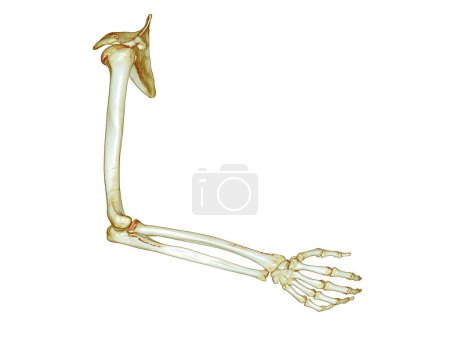 CT SCAN of Arm 3D rendering isolated on white background .Clipping path.