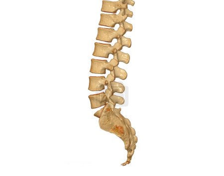 Photo for CT scan of lumbar spine 3D rendering showing Profile Human Spine. Musculoskeletal System Human Body. Structure Spine. Studying Problem Disease and Treatment Methods. isolated on white background. Clipping path. - Royalty Free Image