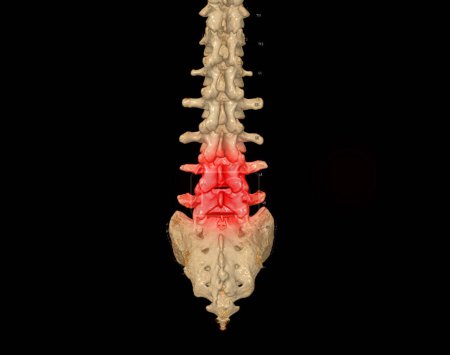 Photo for CT scan of Lumbar spine 3D rendering showing Profile Human Spine. Musculoskeletal System Human Body. Structure Spine. Studying Problem Disease and Treatment Methods. isolated on black background. - Royalty Free Image