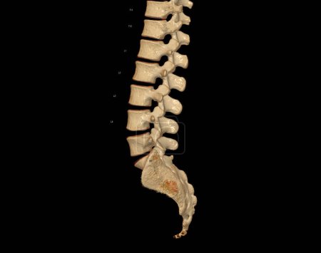 Photo for CT scan of Lumbar spine 3D rendering showing Profile Human Spine. Musculoskeletal System Human Body. Structure Spine. Studying Problem Disease and Treatment Methods. isolated on black background. - Royalty Free Image