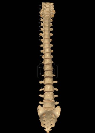 Photo for CT scan of Whole spine 3D rendering showing Profile Human Spine. Musculoskeletal System Human Body. Structure Spine. Studying Problem Disease and Treatment Methods. isolated on black background. - Royalty Free Image