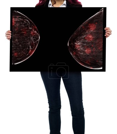 Téléchargez les photos : Sensibilisation au cancer du sein contre la femme pour lutter contre le cancer du sein montrant mammographie numérique à rayons X isolé sur fond blanc. Sentier de coupe. - en image libre de droit