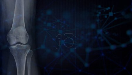 Foto de Film x-ray  of Left knee joint  AP view  for Medical background 3D rendering. - Imagen libre de derechos
