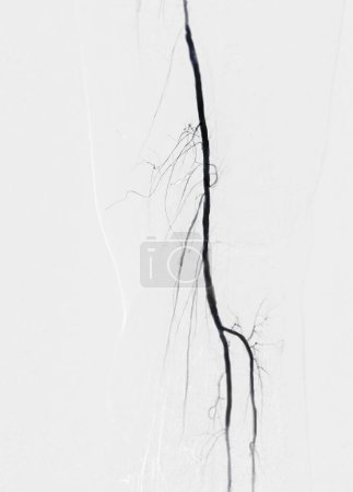 Téléchargez les photos : Angiographie de l'artère fémorale ou angiographie - en image libre de droit