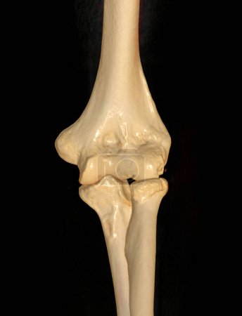 CT scan of elbow joint 3d rendering .